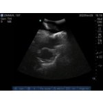 Ultraschalluntersuchung Trainer erweitert  "Echo Eddie"