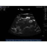 Ultraschalluntersuchung Trainer erweitert  "Echo Eddie"