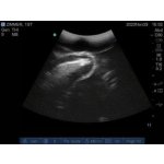 Ultraschalluntersuchung Trainer erweitert  "Echo Eddie"