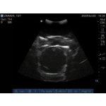 Ultraschalluntersuchung Trainer erweitert  "Echo Eddie"