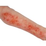 Arm with burns task trainer