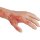 Arm with burns task trainer