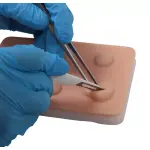Training Pad Cyst and abscess