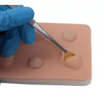 Training Pad Cyst and abscess