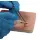Training Pad Cyst and abscess