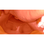 AirSim Difficult Airway