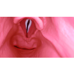 AirSim Difficult Airway