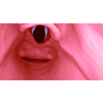 AirSim Difficult Airway