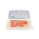 Wound moulage scalding