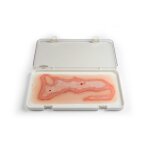 Wound moulage scalding