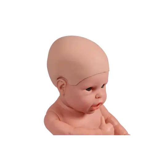 Hydrocephalus cover for baby dolls