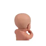 Hydrocephalus cover for baby dolls