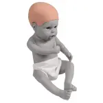 Hydrocephalus cover for baby dolls