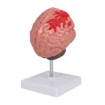 Brain Pathologies