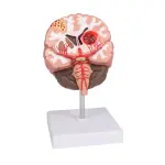 Brain Pathologies