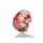 Brain Pathologies