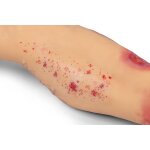 "Lena Leg" - Leg with medical conditions