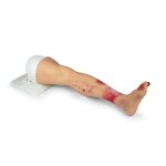 "Lena Leg" - Bein mit Erkrankungen