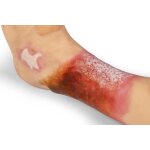 "Lena Leg" - Leg with medical conditions