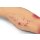 "Lena Leg" - Leg with medical conditions