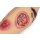 "Lena Leg" - Leg with medical conditions