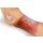 "Lena Leg" - Leg with medical conditions