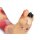 "Lena Leg" - Leg with medical conditions