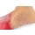"Lena Leg" - Leg with medical conditions
