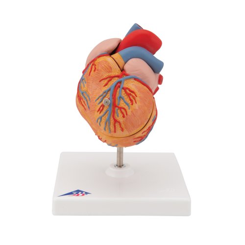 Heart Model with Left Ventricular Hypertrophy (LVH), 2 part - 3B Smart Anatomy