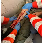 Wound moulage protruding small intestines
