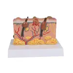 Pathological skin model