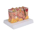 Pathological skin model