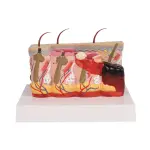 Pathological skin model with burns