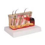 Pathological skin model with burns