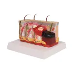 Pathological skin model with burns