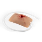 Wundmoulage Schuß Leiste, Wound Packing