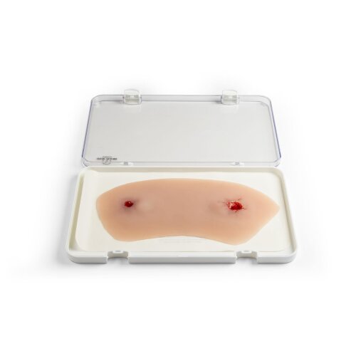 Wundmoulage Schuß Sprunggelenk