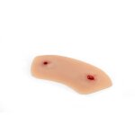 Wundmoulage Schuß Sprunggelenk