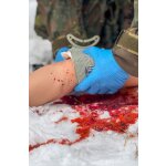 "Trauma Tina" - Arm mit stark blutenden Wunden