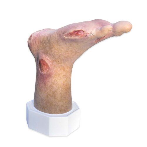Base Model Two-Toed Foot with 6 Wounds - clean wound