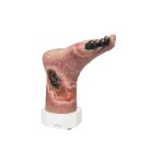 Necrotic foot model