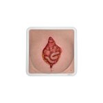 Frame Model Burst Abdomen - clean wound