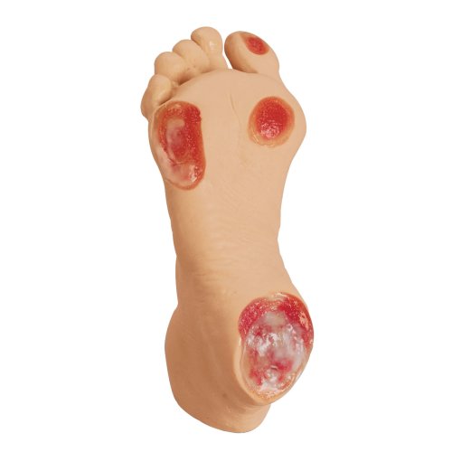 Life/form&reg; Elderly Pressure Ulcer Foot