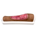 Rahmenmodell Venous Leg Ulcer (VLU) - ven&ouml;ses Beingeschw&uuml;r
