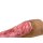 Rahmenmodell Venous Leg Ulcer (VLU) - venöses Beingeschwür
