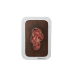 Pocketwound Ulcer - Chronic Wound - clean wound