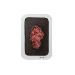 Pocketwound Ulcer - Chronic Wound - clean wound