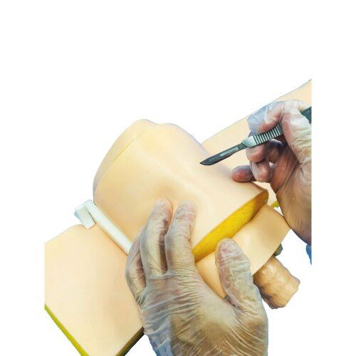 Cricothyroidotomy Adipositas Haut