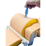 Cricothyroidotomy Adipositas Haut