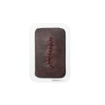Pocketwound Surgical Wound Closed and Inflamed